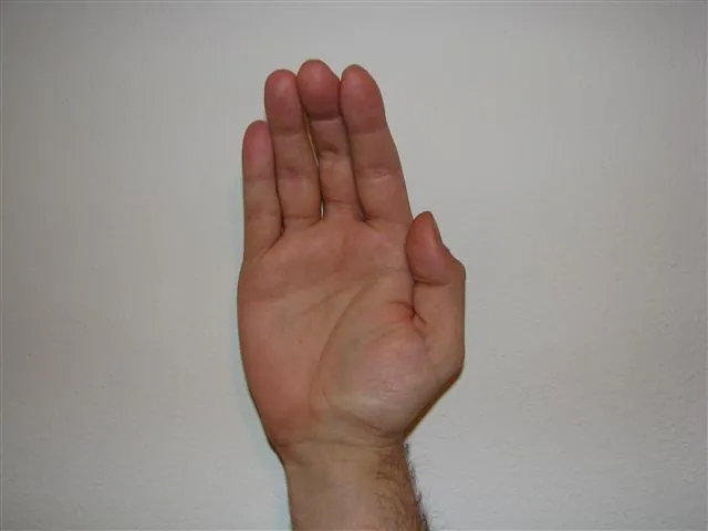 Hand held in the ape hand posture with the thumb in the plane of the palm